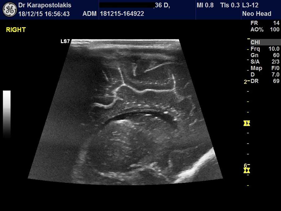 egefalos Εγκέφαλος