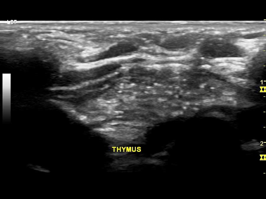 thorakas Θώρακας